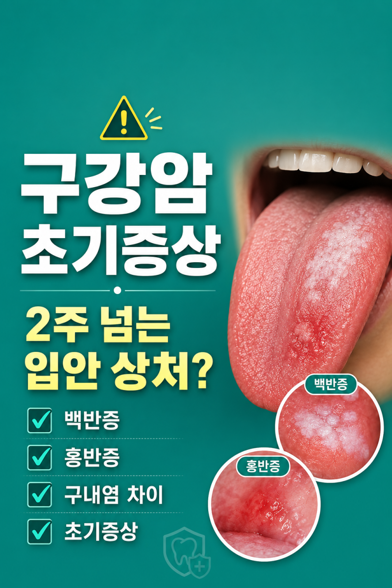 『구강암 초기증상』구내염 차이·원인·구강암종류·구강암예후까지