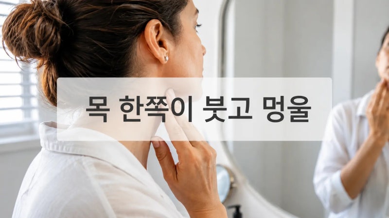 목 한쪽이 붓고 멍울이 잡힌다면? 위치별 원인이 다릅니다