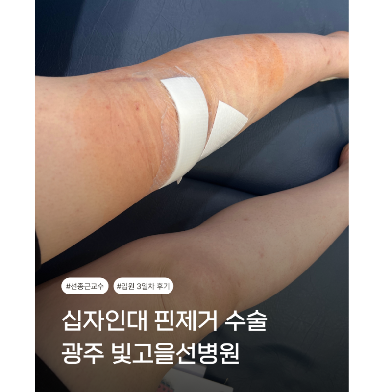 빛고을선병원 수술입원 3일차 상세후기 (십자인대 핀제거 수술 후 재활치료 및 운동)