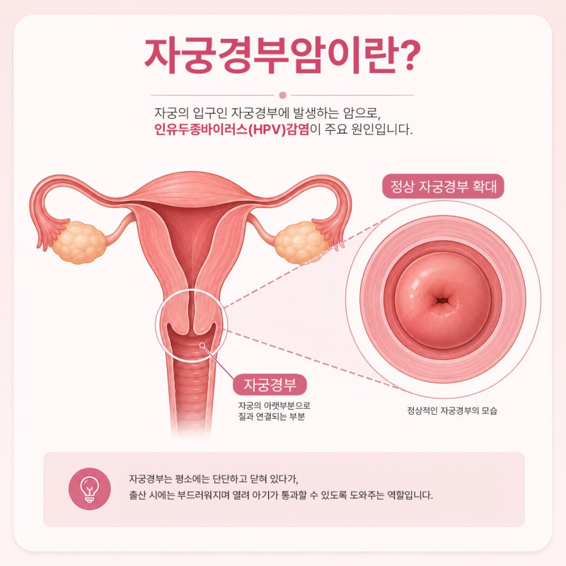 HPV 양성, 자궁경부암인가요? 꼭 알아야 할 초기증상과 검사