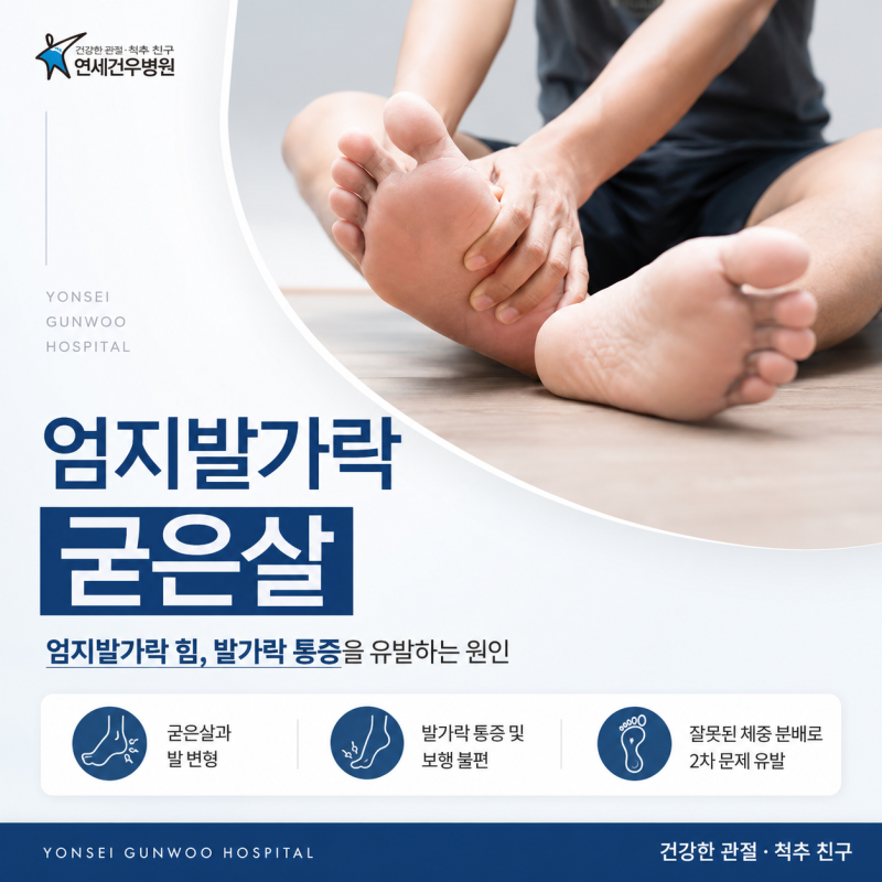 엄지발가락 굳은살 한쪽 발만 반복되고 있다면?
