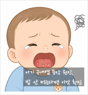 아기 구내염 증상 원인, 밥 안 먹는다면 이것 확인