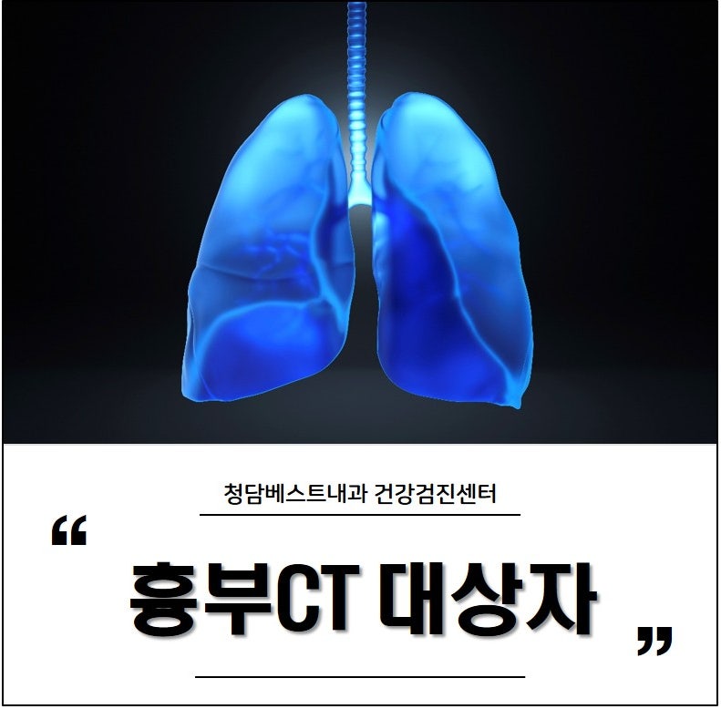 건강검진 시 흉부CT 검사 대상자, 흉부X선 촬영도 있지만 왜?