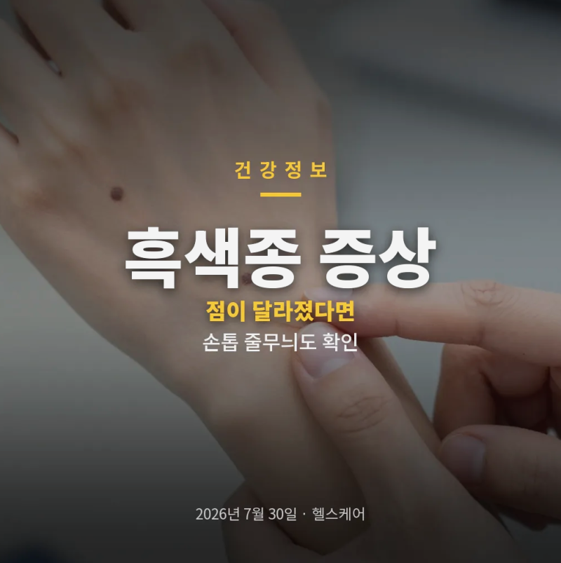 흑색종 증상 단순한 점과 다른 신호 손톱 검은세로줄 확인법