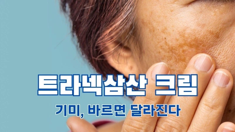 트라넥삼산 크림 효능과 사용법, 부작용부터 나이아신아마이드 조합까지