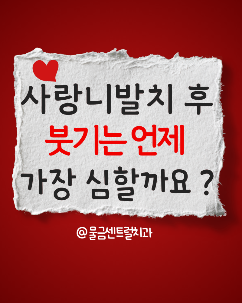 사랑니 발치 후 붓기는 언제 가장 심할까요? | 양산 사랑니발치 후 회복 과정과 붓기 관리법