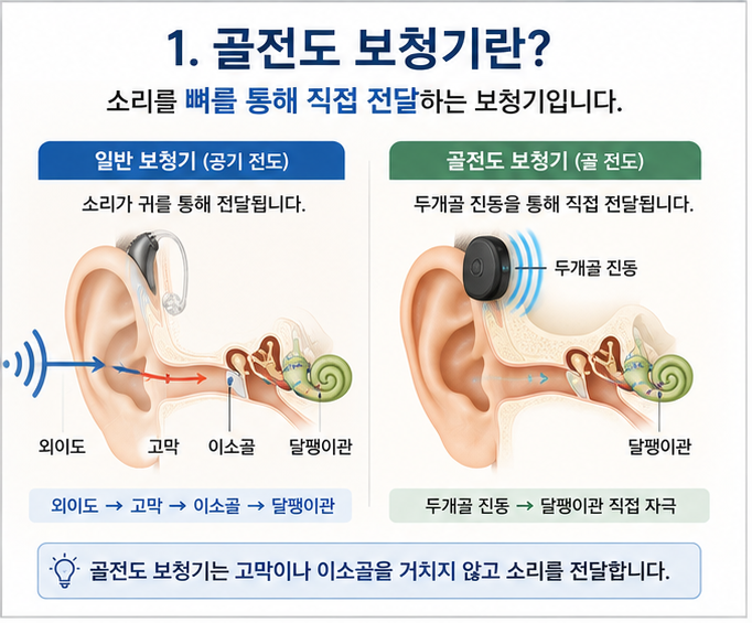 김제보청기. 골전도 보청기란? 일반 보청기와 무엇이 다른가