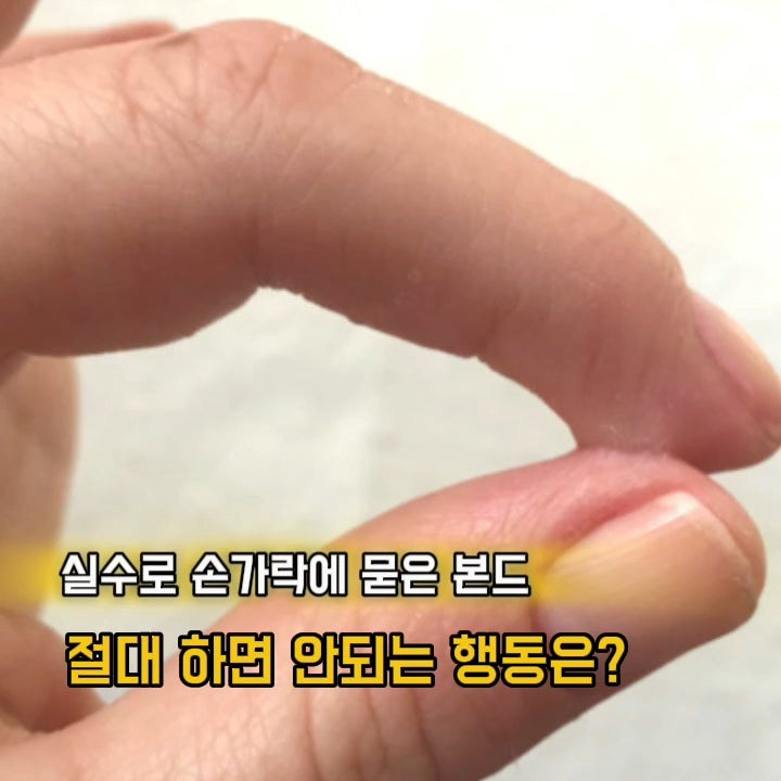 실수로 손에 묻은 강력본드 순간접착제 지우는 제거방법