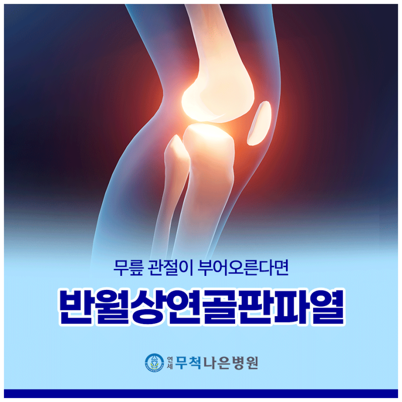 반월상연골파열수술, 꼭 받아야 할까? 수술이 필요한 경우와 치료 방법