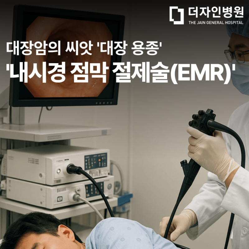 [일산 외과] 대장 용종, 수술 없이 뿌리 뽑는 내시경 점막 절제술(EMR)