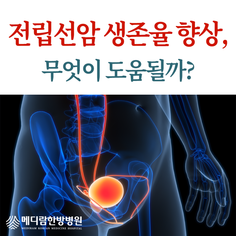 전립선암 3기 생존율 향상에 도움되는 것은?