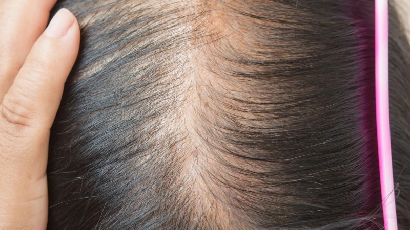 모발콜라겐 효과와 복용법, 저분자콜라겐이 머리카락에 미치는 영향까지 정리