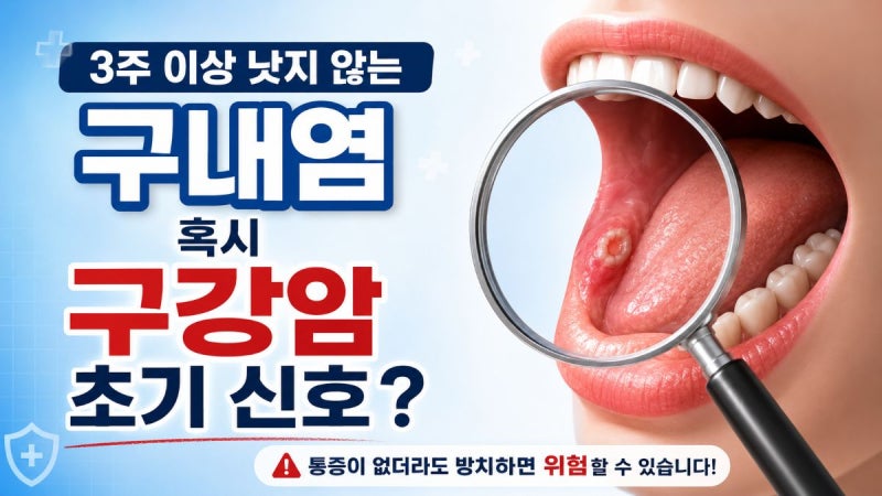 [경고] 단순한 구내염인 줄 알았는데... 혀가 헐고 아프다면 '이것' 의심하세요!
