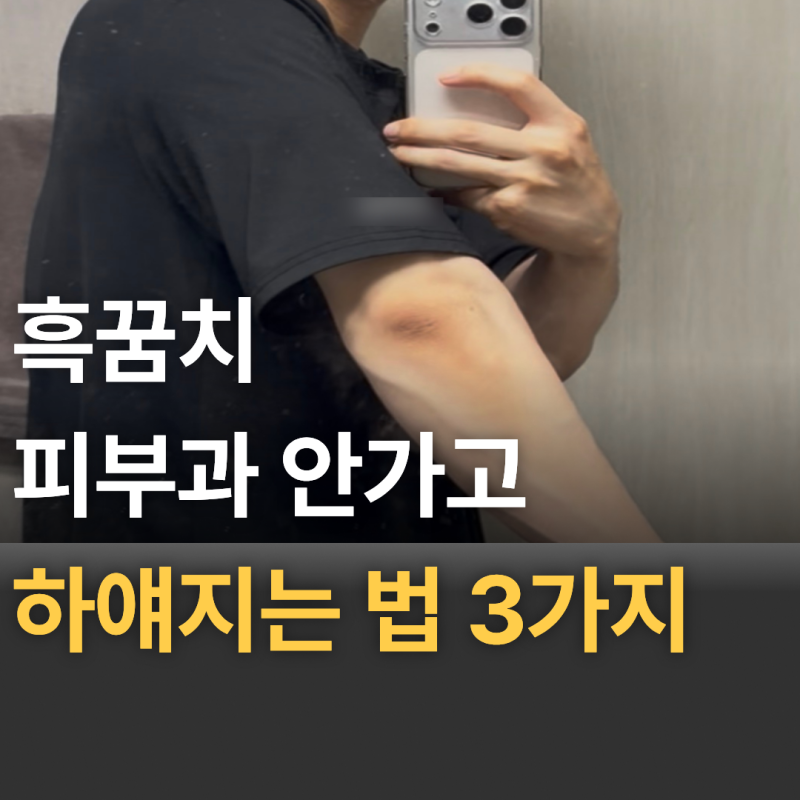 흑꿈치 제거, 피부과 안 가고 하얘지는법 3가지(feat.흑꿈치 크림)