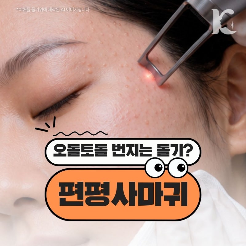 광주편평사마귀치료 수완지구비립종제거, 번지기 전 확인해야 할 차이