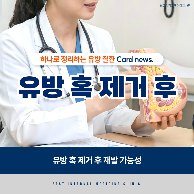 유방 혹 제거 후 재발 가능성