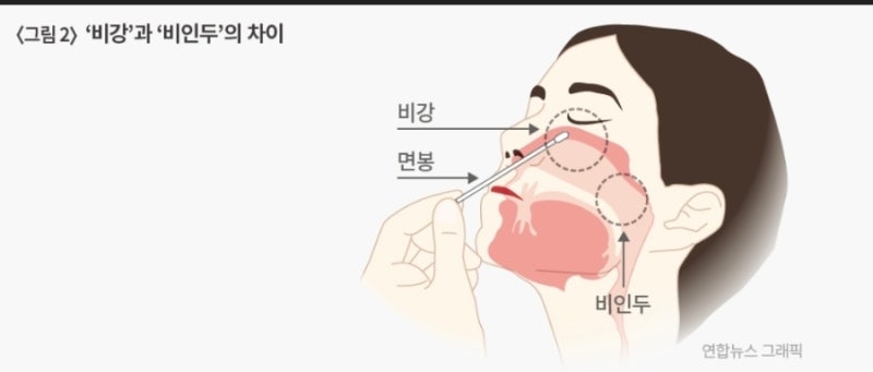 호흡기 PCR 검사, 폐렴원인균 검사란 ?