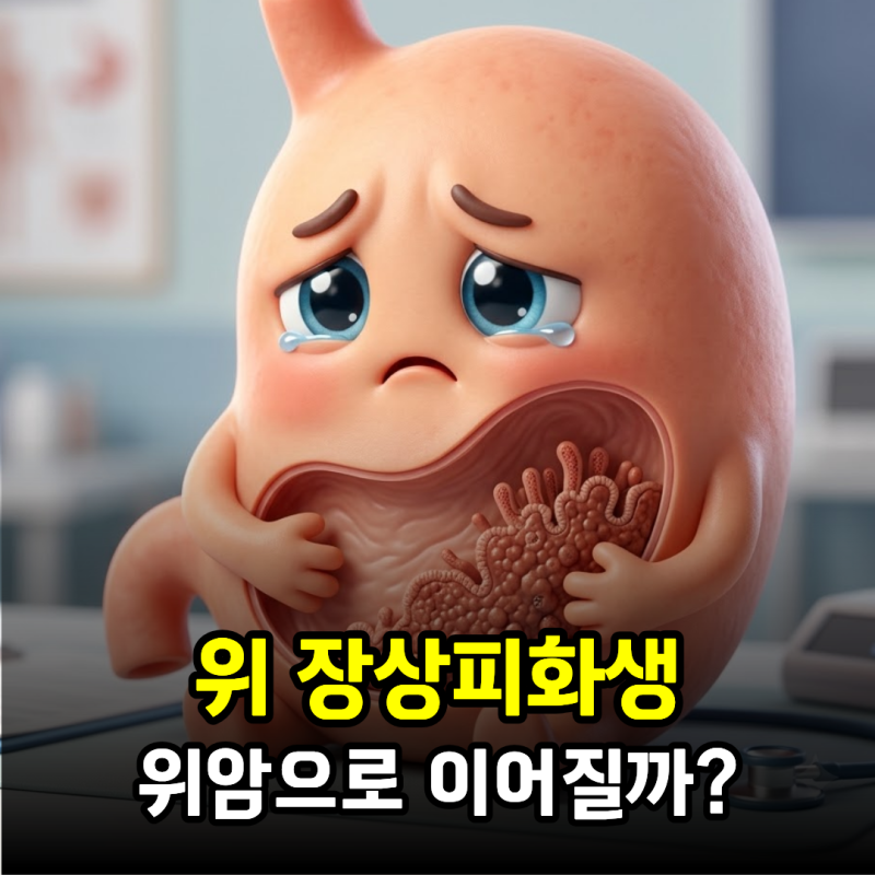 위 장상피화생, 위암으로 이어질까? 증상부터 치료·완치·좋은 음식까지