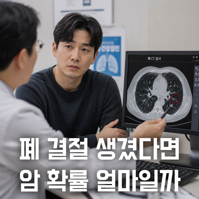 폐 CT에서 결절이 나왔는데, 암 확률 얼마일까