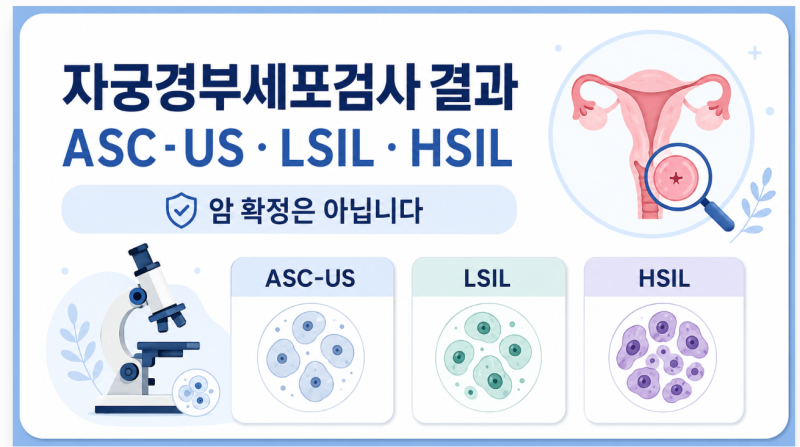 자궁경부세포검사 결과 ASC-US·LSIL·HSIL은 무슨 뜻일까?