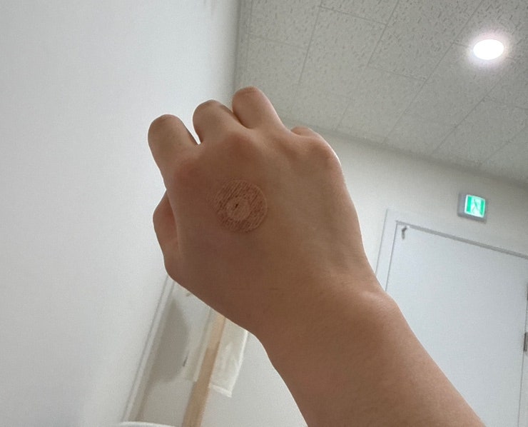 출산 후 치핵수술후기,, 내가 치질수술을 할 줄이야ㅋ..