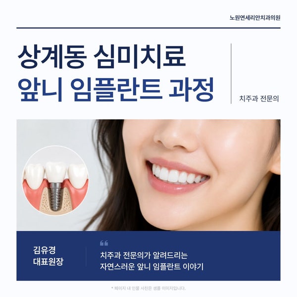 상계동 심미치료, 앞니 임플란트 과정과 기간 얼마나 걸릴까요?