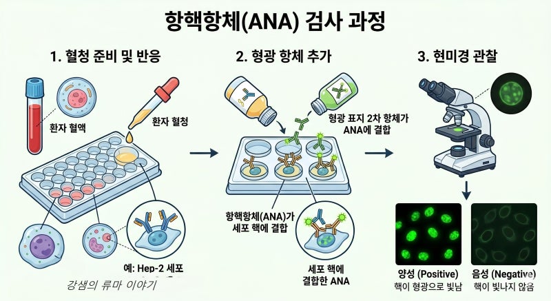 [루푸스 진단 2편] "항핵항체(ANA) 양성이면 루푸스인가요?" - 혈액 검사 결과지 해석 (자가항체....