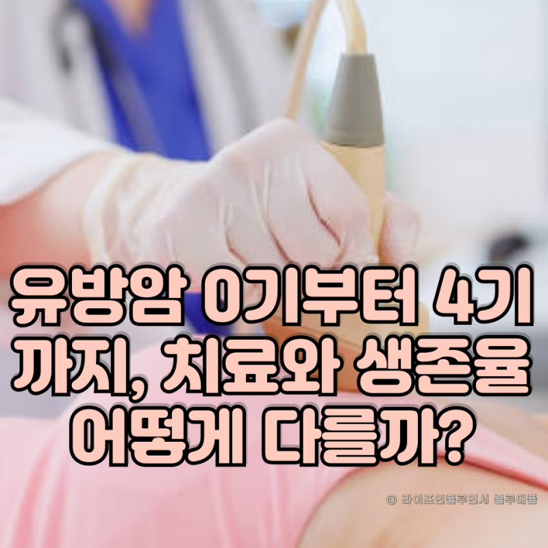 유방암 0기 1기 2기 3기 4기, 치료와 생존율 어떻게 다를까?