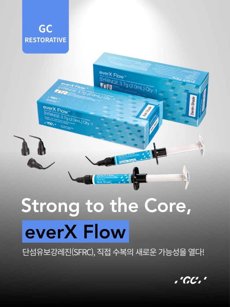 [탕정치과] 자연치아 수명을 늘리는 바이오미메틱 치료 : 단섬유 보강형 레진 GC everX Flow 신규 도입 / 천안 아산