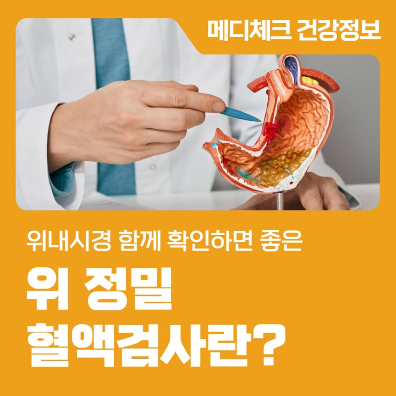 서울 건강검진센터 위내시경 함께 확인하면 좋은 '위 정밀 혈액 검사'란?