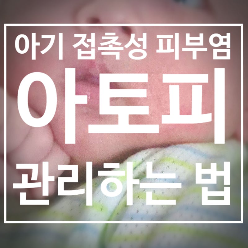 아기 접촉성 피부염이 아토피로 악화?! 아토피 피부염 초기증상과 관리하는 법.