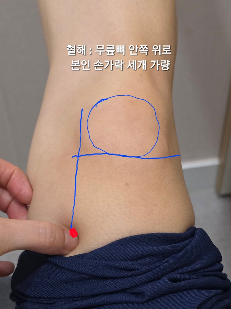 생리 빨리 터지는 혈자리? 생리가 늦을 때 눌러보는 혈자리 3가지