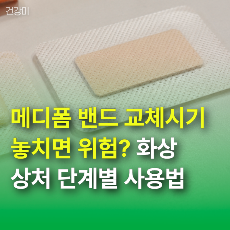 메디폼 밴드 교체시기 놓치면 위험? 화상 상처 단계별 올바른 사용법
