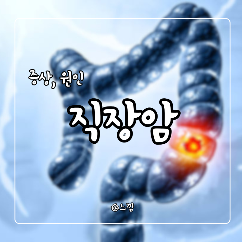 직장암 초기증상 전이 직장암 4기 생존율