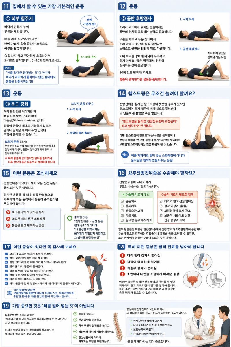 허리 과전만이 있다면 꼭 확인하세요!허리뼈가 앞으로 밀리는 ‘요추전방전위증’ 원인과 ....