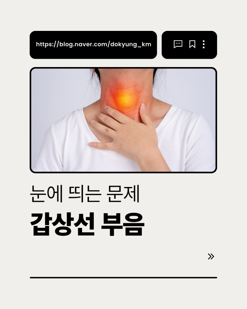 갑상선부음 갑상선 초음파 검사 호르몬수치 TSH 걱정되면