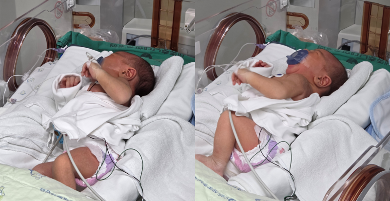 응급제왕·NICU 입원 태아보험 보험금 수령 실제 후기
