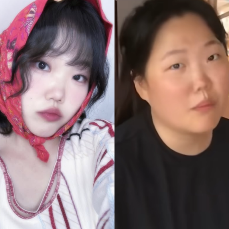 "위고비 아니었습니다" 30kg 감량한 악뮤 이수현이 밝힌 진짜 비결