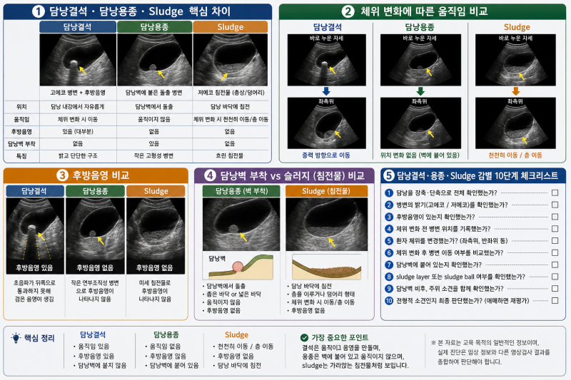 담낭결석 vs 담낭용종 vs Sludge초음파에서 어떻게 구분할까? -움직임·후방음영·담낭벽 부착 ....
