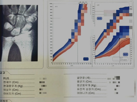 청소년 키성장 영양제 3개월 먹이고 5.4cm 컸어요, 중2 아들 솔직 후기