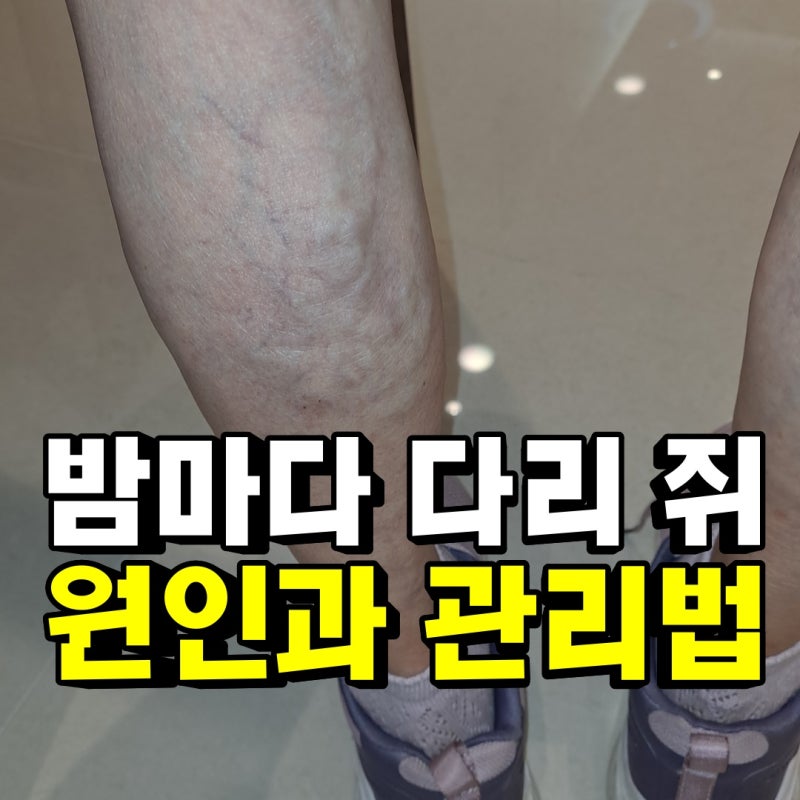 미금역 하지정맥류 다리 통증과 저림 쥐가 반복될때 8주 치료과정