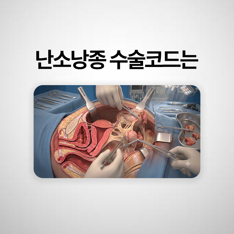 난소낭종 수술코드와 행위분류번호는