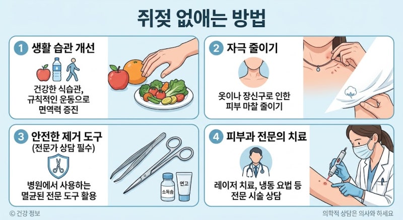 쥐젖 없애는 방법, 집에서 제거하면 안 되는 이유와 피부과 치료