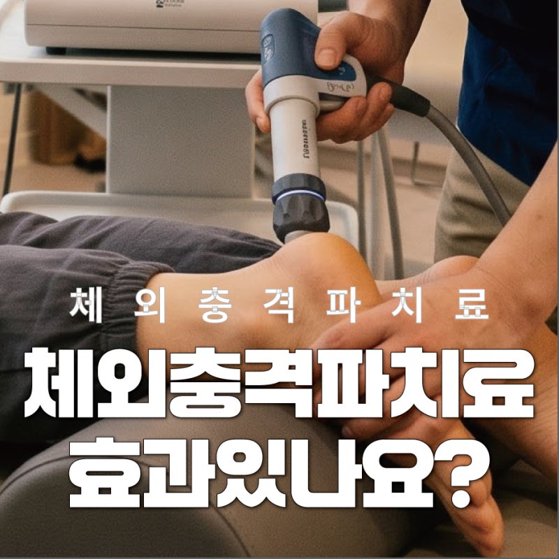 대구정형외과, 체외충격파치료 효과,원리부터 치료 주기, 부작용까지(재활의학과 전문의 팩....