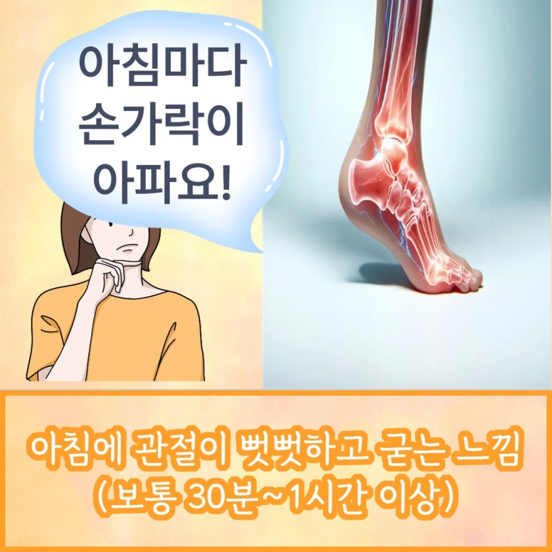 인천 부평구 손가락 마디 통증 원인 류마티스관절염 증상일 수 있습니다