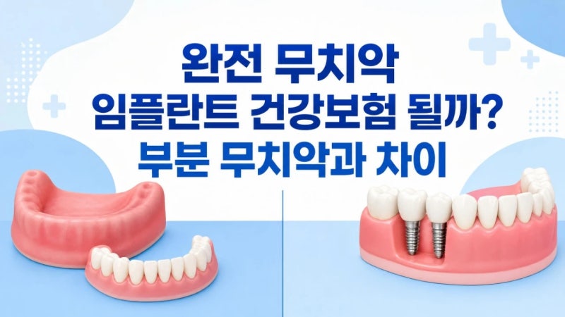 완전 무치악 임플란트 건강보험 될까, 부분 무치악과 차이