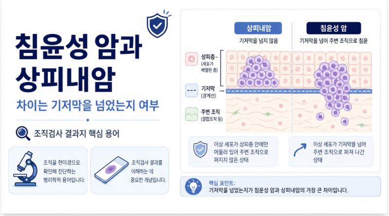 조직검사 결과지에서 침윤성 암과 상피내암은 무슨 차이일까?