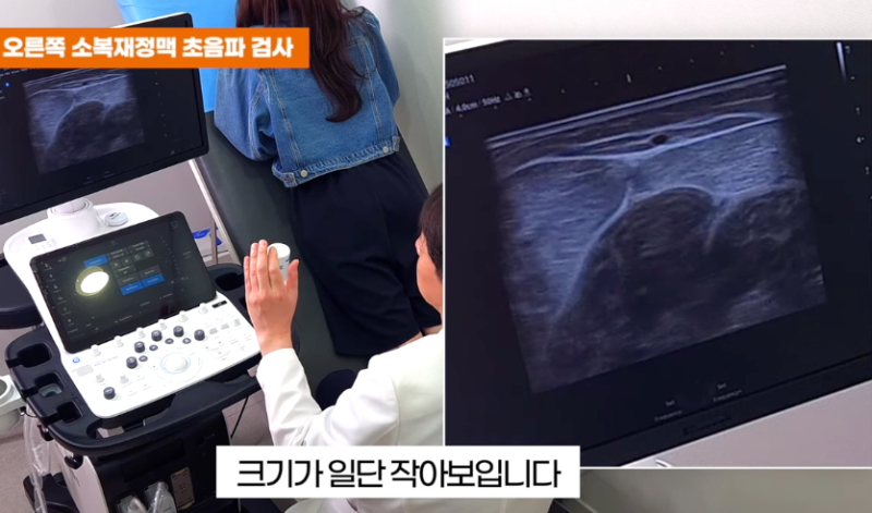 서울하지정맥류병원 추천해 주세요 어떻게 선택해야 할까요? 3가지 기준