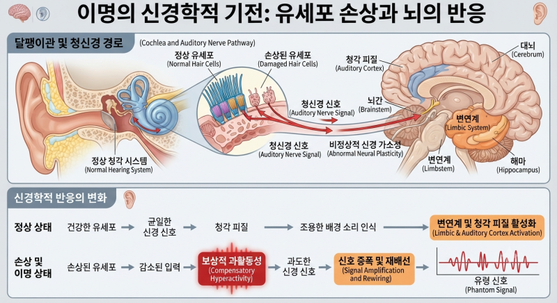 귀에서 매미 우는 소리가 나는데, 이명일까
