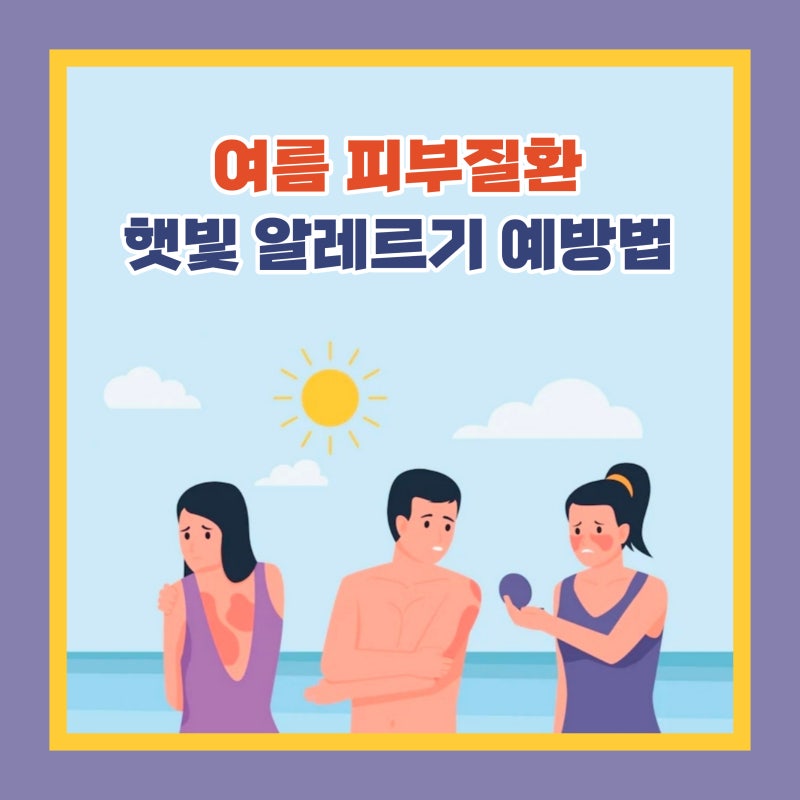 한여름 피부질환, 햇빛알레르기 예방법